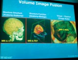 uImage Fusion, Visualization and Analysis For Medical Procedures and Surgical Navigation : A Personal Perspective