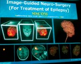 uImage Fusion, Visualization and Analysis For Medical Procedures and Surgical Navigation : A Personal Perspective