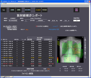 図2　放射線被ばく管理画面　DICOM画像の附帯情報から撮影条件を取得し、検査、治療中の局所皮膚被ばくをリアルタイム表示