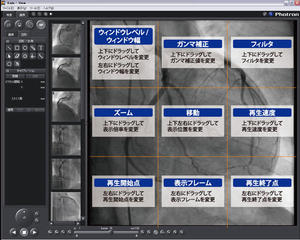 図4　Kadaインターフェース　画像の表示エリア内にコマンドが割り当てられており，動画像から目を離さずに迅速、簡単に画像操作が行える