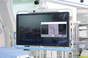 58インチ「FlexVision XL」で透視画像や術前CTなどの画像を大画面に表示