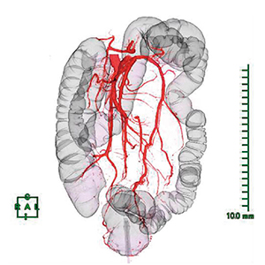 図3　大腸CT造影検査
