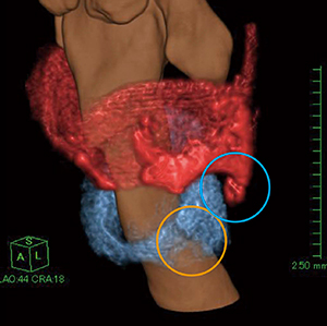 図4　セミオート抽出機能を使用して作成した喉頭軟骨VR画像