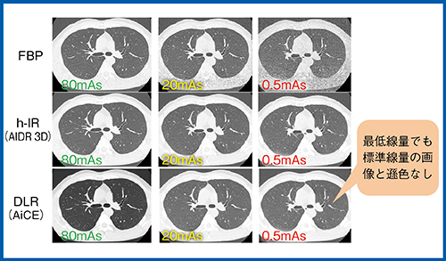 図4　各線量域における肺野画像の比較