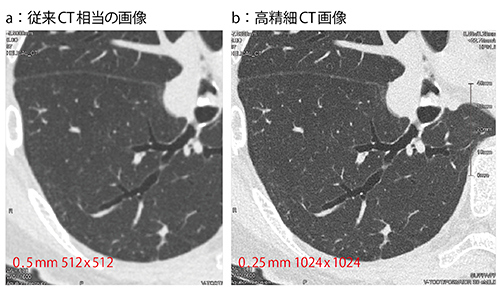 図2　従来CT相当と高精細CT画像の比較 高精細CT（b）では、肺野の既存構造の輪郭が明瞭であり、血管はより白く、気管支はより黒く描出されている。