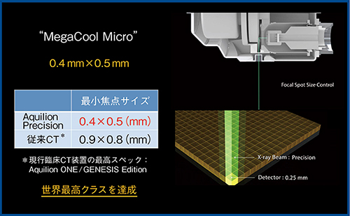図4　高精細X線管“MegaCool Micro”