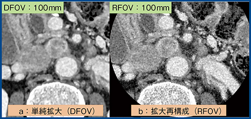 図1　DFOV画像（a）とRFOV画像（b）の比較