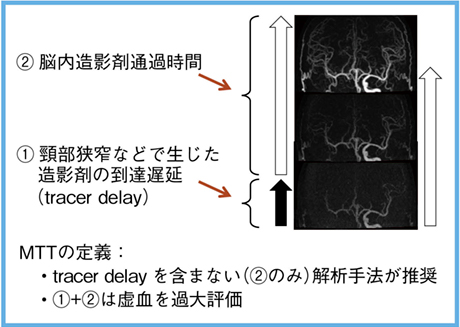 図2　CT perfusionの画像解析方法におけるtracer delayの影響2）