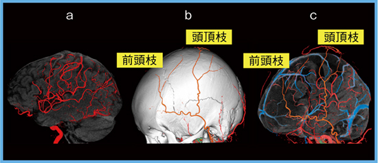 図2　中大脳動脈皮質枝，前頭枝，頭頂枝