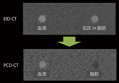図2　石灰化プラークを想定した物質弁別実験画像