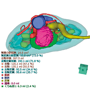 図2　CT画像から腎臓，動脈を自動抽出したシミュレーション画像