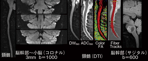 図2　FOCUSの画像例　DWIの撮像時間は3〜4分