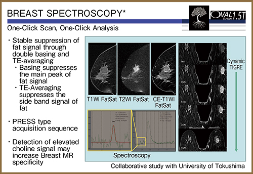 図3　日立メディコ社のBreast Spectroscopyの概要