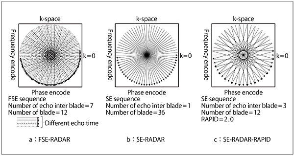 図2　FSE-RADAR（a）とSE-RADAR（b），SE-RADAR-RAPID（c）のk-space充填法