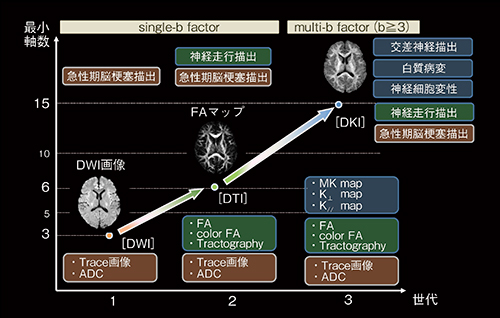 図2　DWI撮像機能の進化