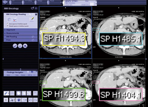 図3　MM Oncology 位置合わせ機能で異なるシリーズを同期させて表示