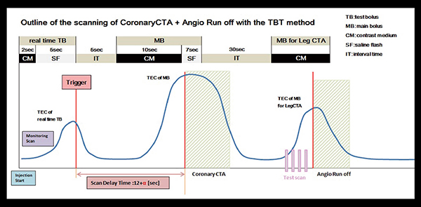 図3　TBT法を応用した造影剤分割一連注入のワークフロー