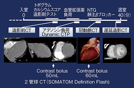図1　当院における包括的心臓CT検査のプロトコル