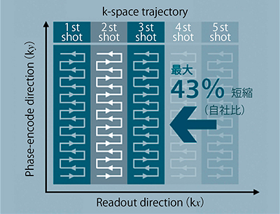 図5　RESOLVEのk-space trajectory（概念図）