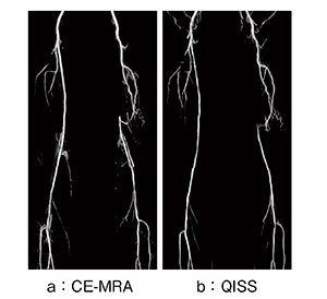 図6　造影MRAとQISSの比較