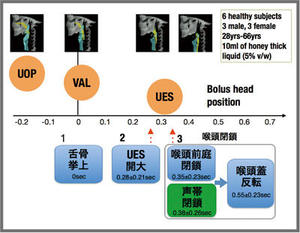 図14　喉頭閉鎖の時間的関係