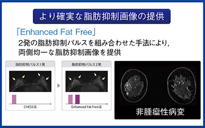 図2　東芝独自の脂肪抑制法“Enhanced Fat Free”