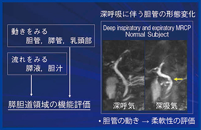図1　MRIによる膵胆道領域の機能動態イメージング（深呼吸に伴う胆管の形態変化）