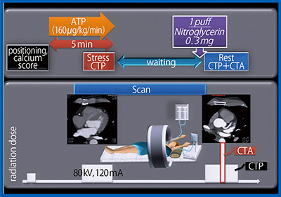 図2　当院における包括的心臓CTプロトコール