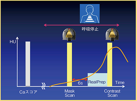 図2　1呼吸法（RealPrep法）の撮影法