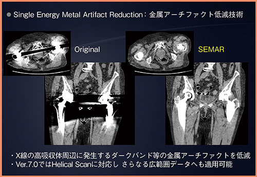 図3　SEMAR for Helical Scan