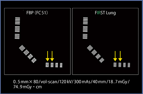 図3　FBPとFIRSTの空間分解能の比較
