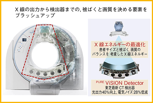 図1　PUREViSION Optics