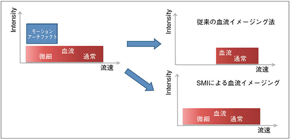 図2　従来の手法とSMIによる血流イメージングの比較