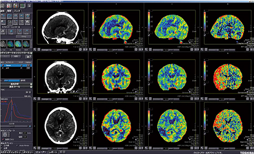 図4　4D脳血流解析（MPR結果画面）