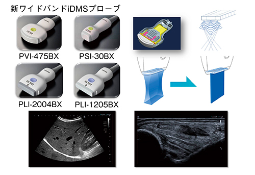 図3　iDMSプローブと超高周波リニアプローブによる高精細画像