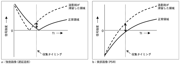 図1　TIによるコントラスト差の模式図