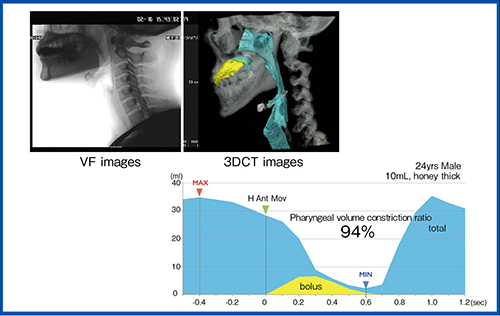 図6　嚥下CTによる咽頭収縮の体積変化の評価