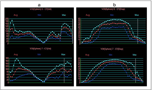図7　Dynamic VOIにてモーション解析をしたグラフ（上段：腫瘍部位、下段：肺底）