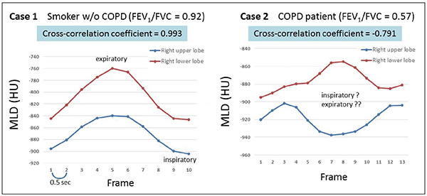 図3　非COPD患者、COPD患者におけるDynamic VOI計測の結果（右上葉・右下葉のみ提示）