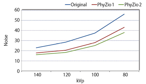 図7　PhyZiodynamicsによるノイズ低減効果