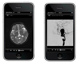 図2　左図MRIのView。右図DSAのView　高解像度で見ることが可能