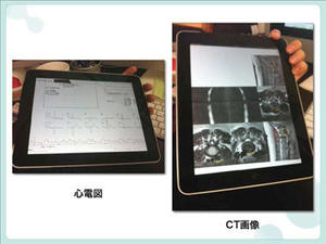 図3　iPadに表示した心電図とCT画像