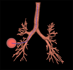 気管支3D画像（図3）