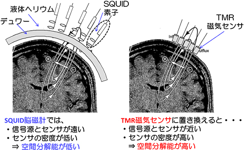 図1-2 従来のSQUID脳磁計とTMR磁気センサによる脳磁計の比較
