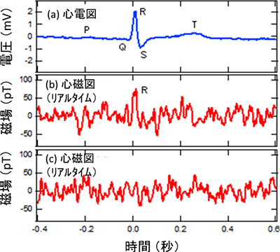 図3-1 TMR磁気センサで測定したリアルタイム心磁図と心電図の比較 （a）心電波形, （b）Rピークが観測できた心磁図, （c）Rピークが観測できなかった心磁図