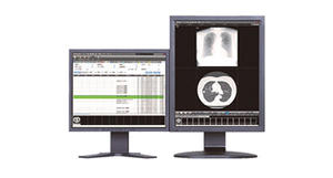 医用画像管理システム「NEOVISTA I-PACS SX2 C-Ed.ソフトウェア」