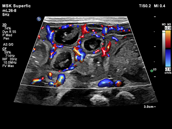 mL26-8画像　腸管（カラー・Flow Viewer）