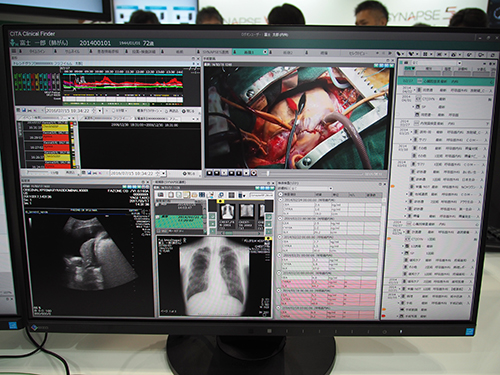 手術記録の動画や生体情報データを表示した術後のポータル画面