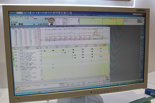病院向けの電子カルテシステム「Medicom-HS」の入院患者カルテ画面