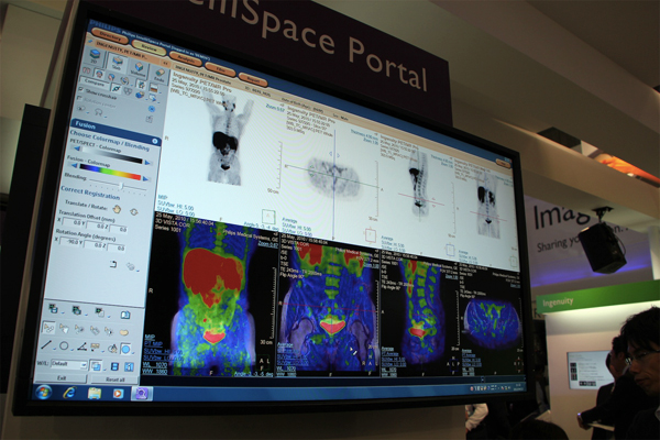 Ingenuity TF PET/MRによる臨床画像をディスプレイ。がん転移の全身のスクリーニングの画像。IntelliSpace Portalで表示している。